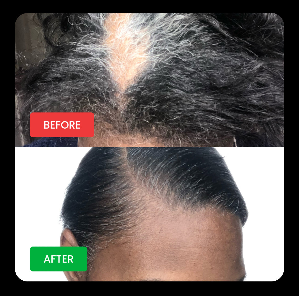 PHENOM Hair Growth Oil